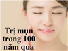 Bất ngờ khi biết 100 năm trước đây, chị em từng trị mụn bằng... đá!